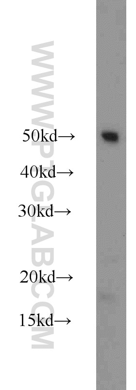 Western Blot (WB) analysis of human placenta tissue using Dysadherin Polyclonal antibody (12166-1-AP)