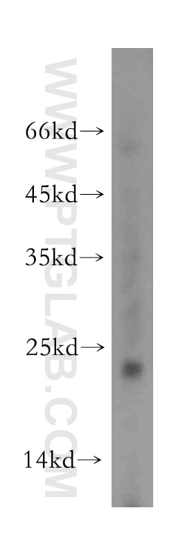 Western Blot (WB) analysis of mouse small intestine tissue using Dysadherin Polyclonal antibody (12166-1-AP)