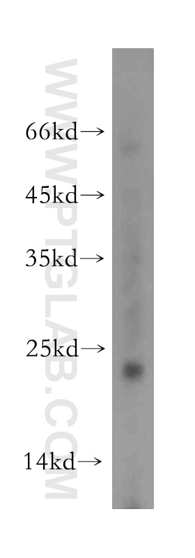 WB analysis of mouse small intestine using 12166-1-AP