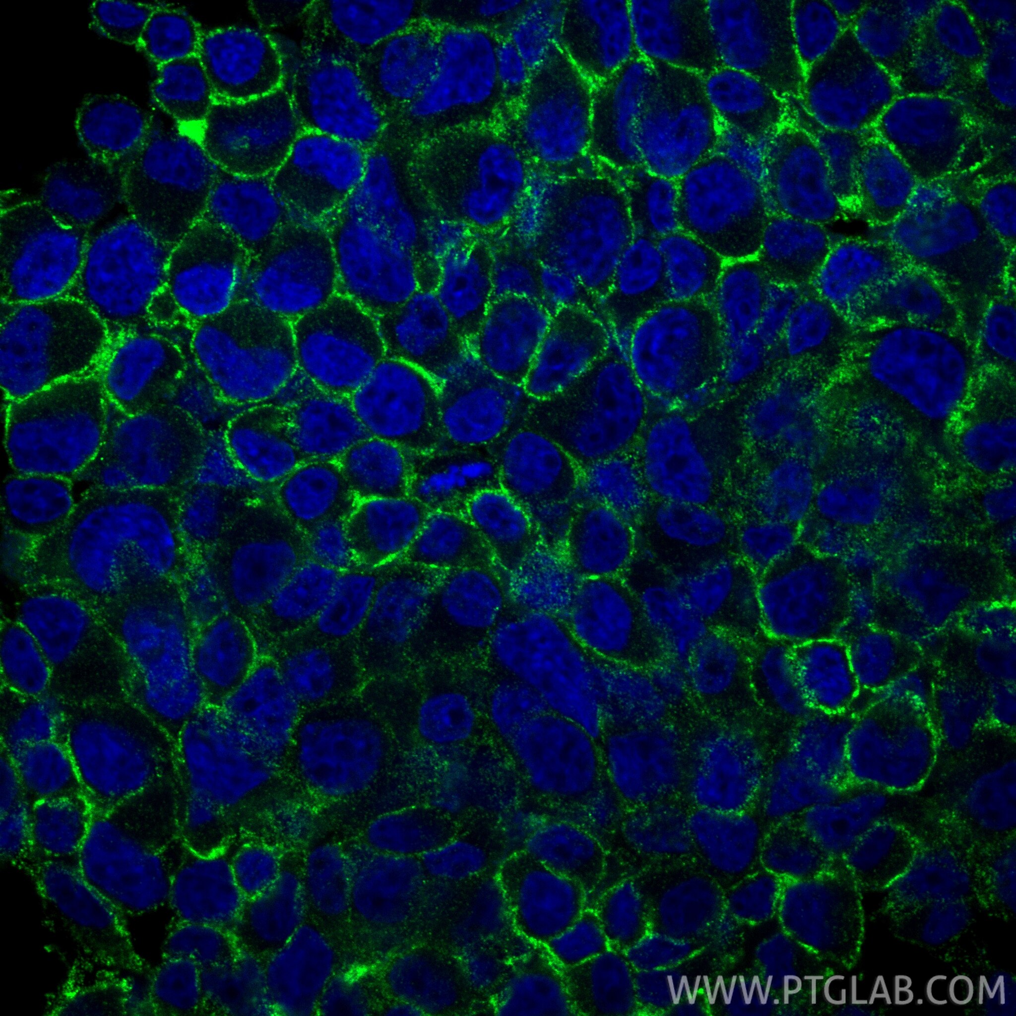 Immunofluorescence (IF) / fluorescent staining of PC-12 cells using FXYD6 Polyclonal antibody (15805-1-AP)