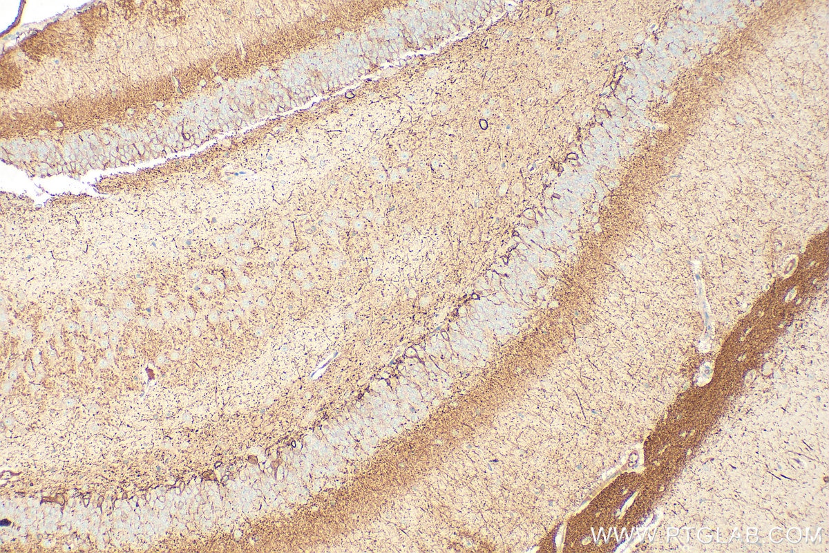Immunohistochemistry (IHC) staining of rat brain tissue using FXYD6 Polyclonal antibody (15805-1-AP)