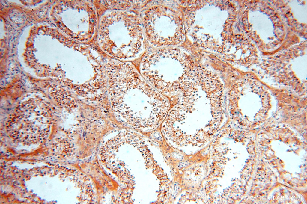 Immunohistochemistry (IHC) staining of human testis tissue using FXYD6 Polyclonal antibody (15805-1-AP)