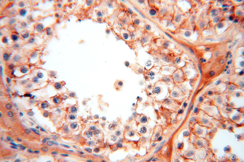 Immunohistochemistry (IHC) staining of human testis tissue using FXYD6 Polyclonal antibody (15805-1-AP)
