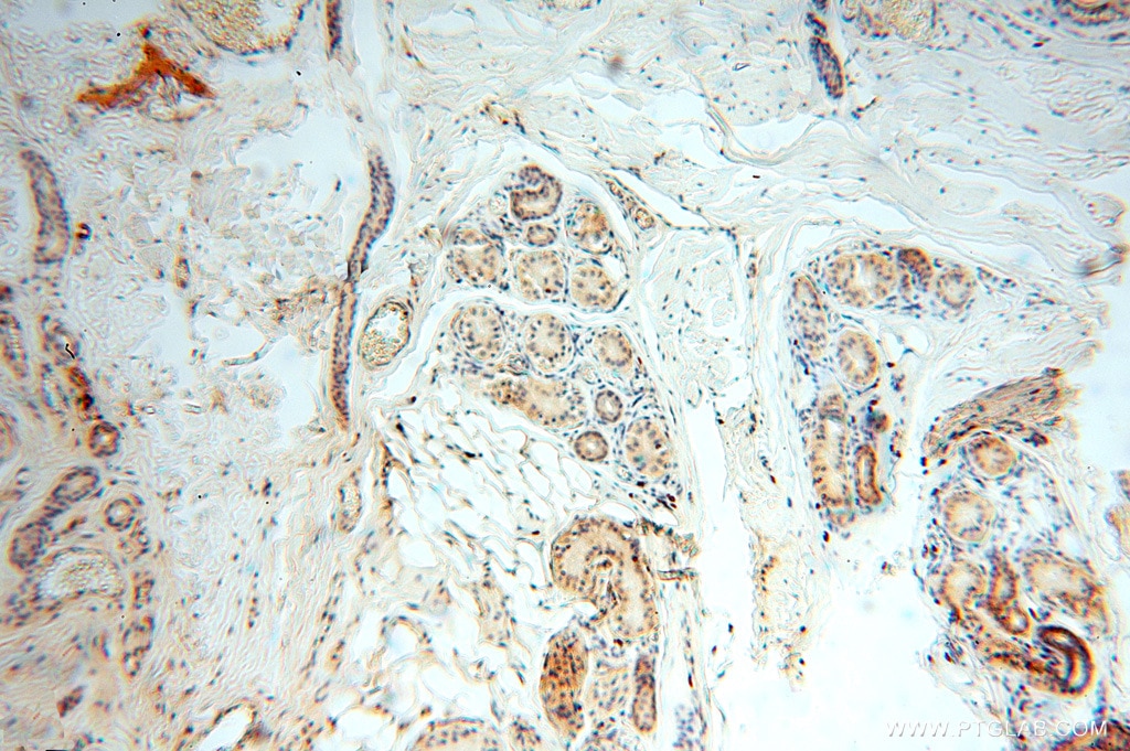 Immunohistochemistry (IHC) staining of human skin tissue using FXYD6 Polyclonal antibody (15805-1-AP)