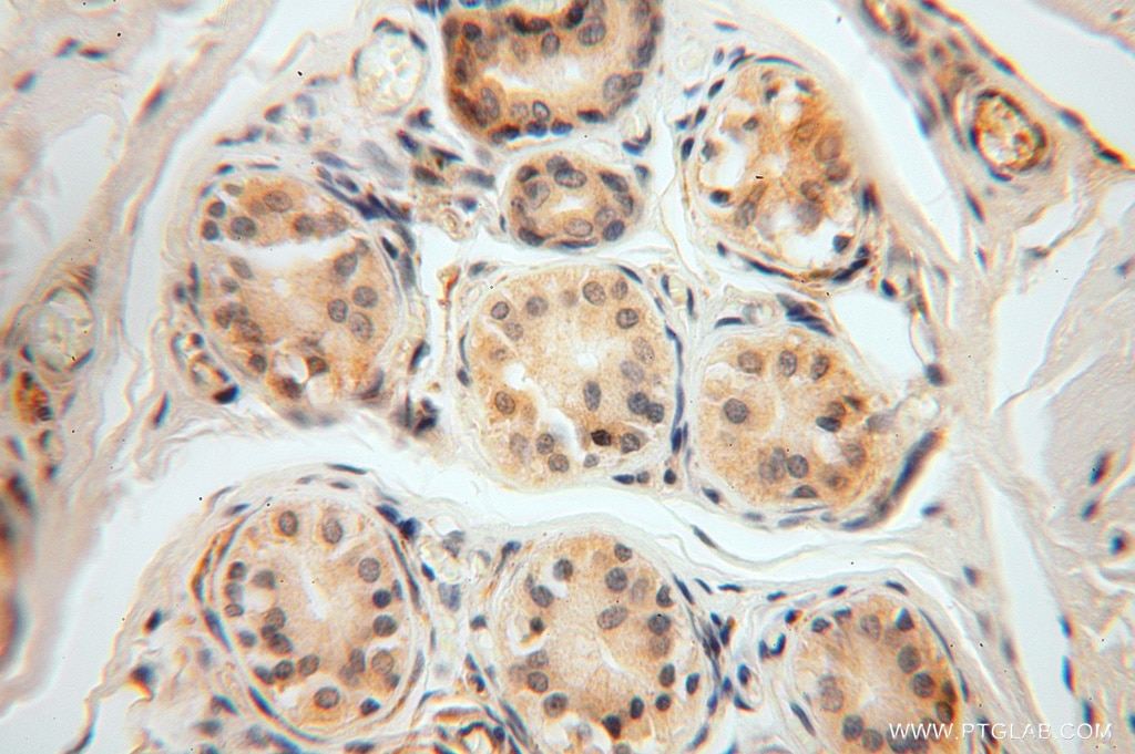 Immunohistochemistry (IHC) staining of human skin tissue using FXYD6 Polyclonal antibody (15805-1-AP)