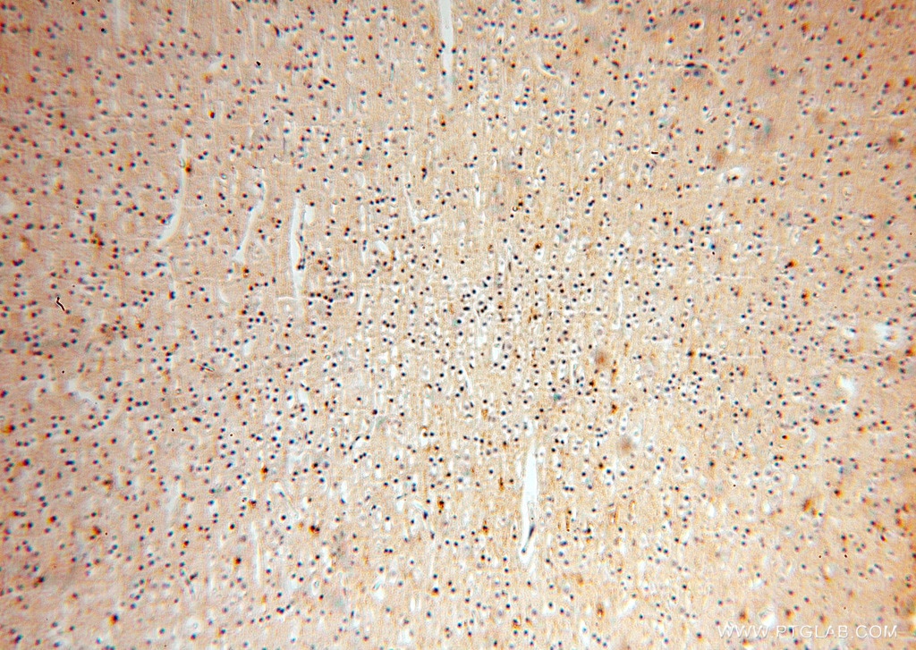 Immunohistochemistry (IHC) staining of human brain tissue using FXYD6 Polyclonal antibody (15805-1-AP)