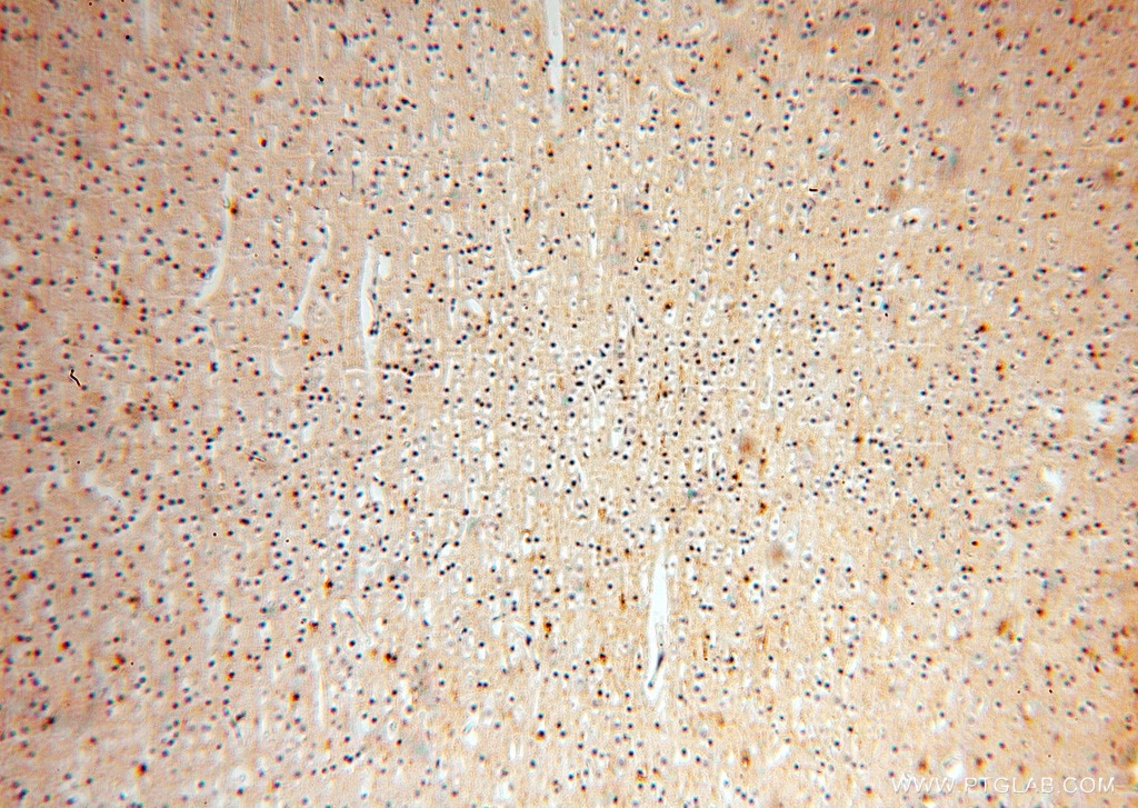 Immunohistochemistry (IHC) staining of human brain tissue using FXYD6 Polyclonal antibody (15805-1-AP)