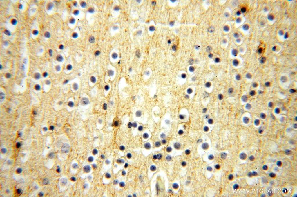 Immunohistochemistry (IHC) staining of human brain tissue using FXYD6 Polyclonal antibody (15805-1-AP)