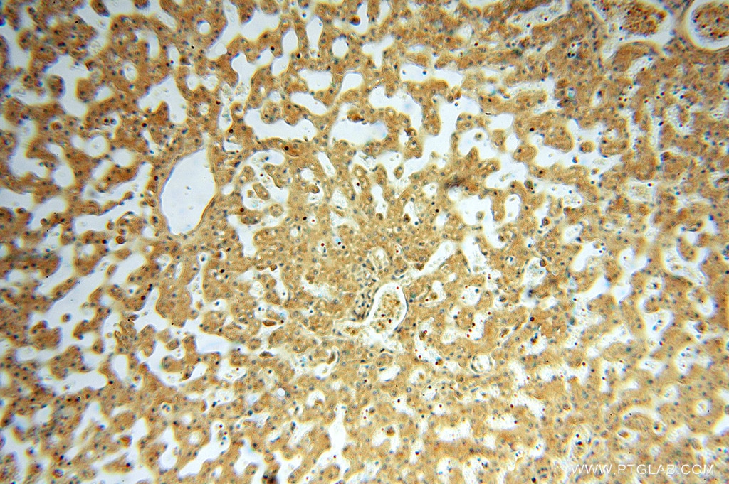 Immunohistochemistry (IHC) staining of human liver tissue using FXYD6 Polyclonal antibody (15805-1-AP)