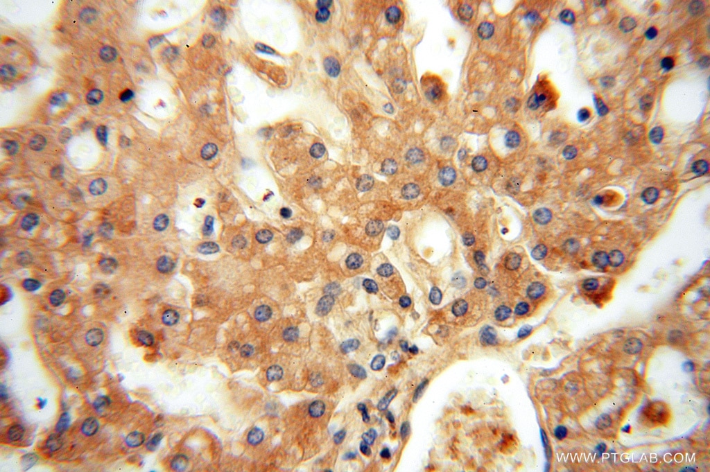 Immunohistochemistry (IHC) staining of human liver tissue using FXYD6 Polyclonal antibody (15805-1-AP)
