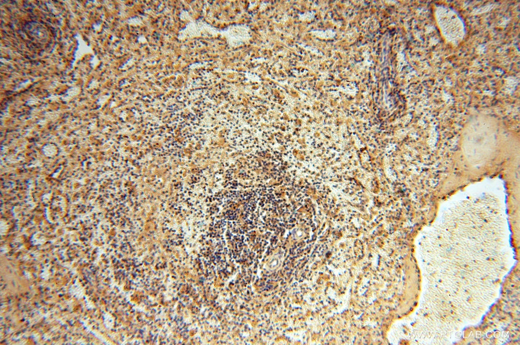 Immunohistochemistry (IHC) staining of human spleen tissue using FXYD6 Polyclonal antibody (15805-1-AP)