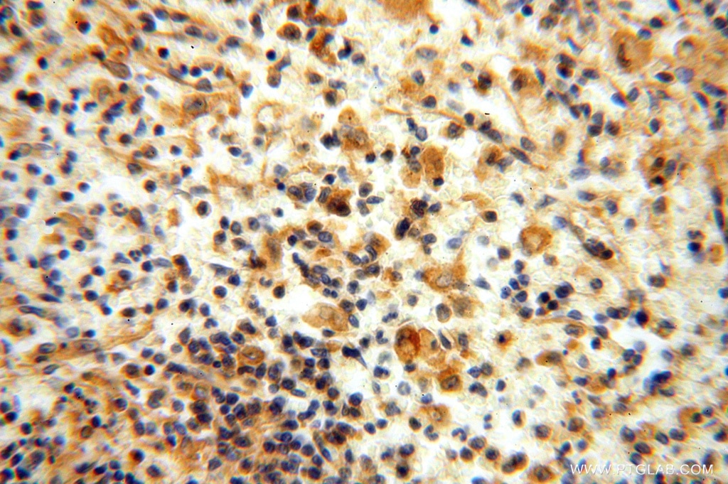 Immunohistochemistry (IHC) staining of human spleen tissue using FXYD6 Polyclonal antibody (15805-1-AP)