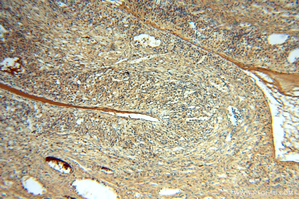 Immunohistochemistry (IHC) staining of human ovary tissue using FXYD6 Polyclonal antibody (15805-1-AP)