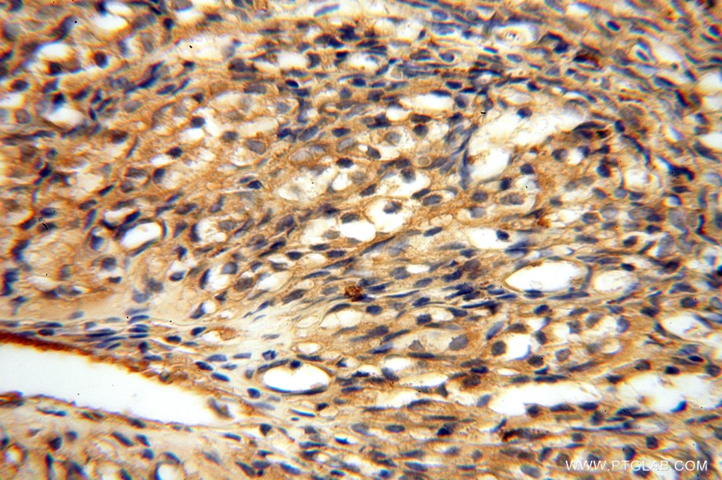 Immunohistochemistry (IHC) staining of human ovary tissue using FXYD6 Polyclonal antibody (15805-1-AP)