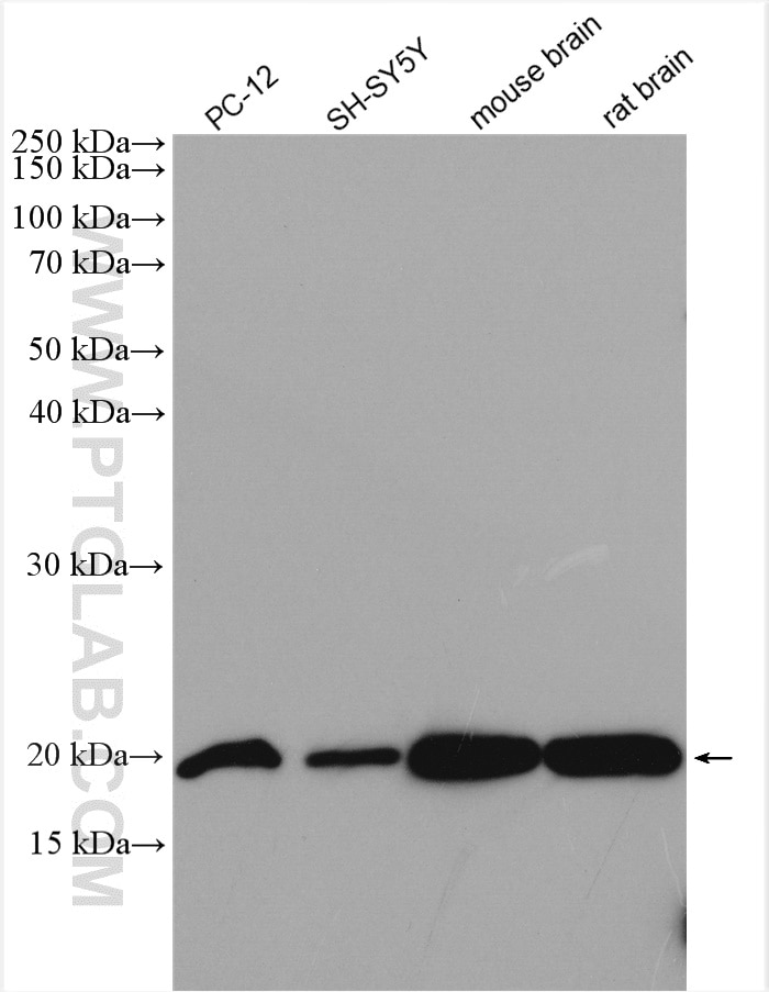 Western Blot (WB) analysis of various lysates using FXYD6 Polyclonal antibody (15805-1-AP)