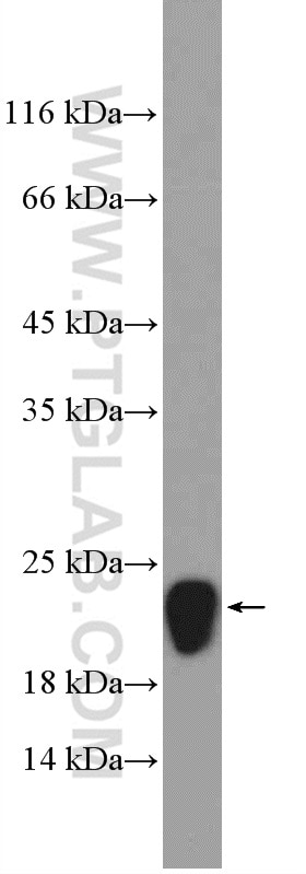 Western Blot (WB) analysis of mouse brain tissue using FXYD6 Polyclonal antibody (15805-1-AP)