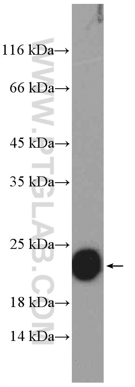 Western Blot (WB) analysis of rat brain tissue using FXYD6 Polyclonal antibody (15805-1-AP)