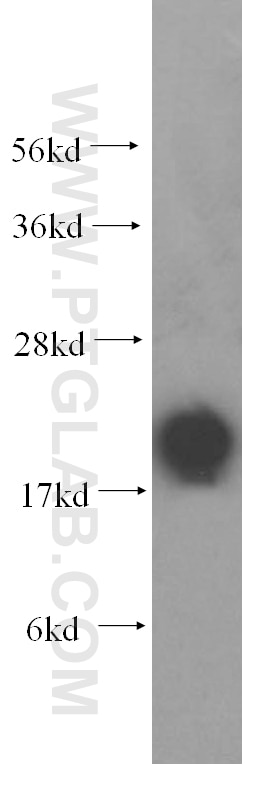 Western Blot (WB) analysis of human brain tissue using FXYD6 Polyclonal antibody (15805-1-AP)