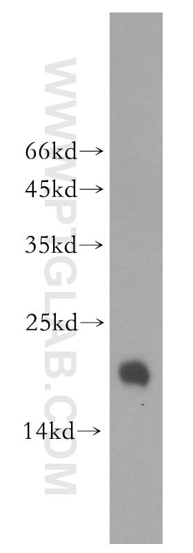 Western Blot (WB) analysis of human testis tissue using FXYD6 Polyclonal antibody (15805-1-AP)