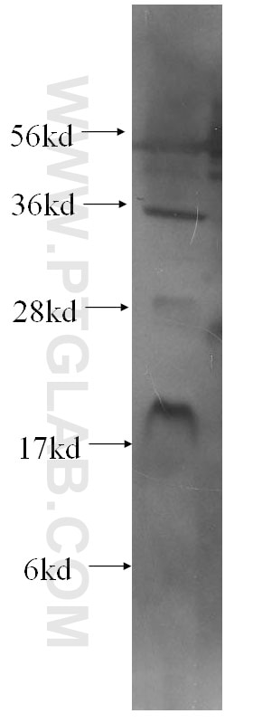 Western Blot (WB) analysis of human heart tissue using FXYD6 Monoclonal antibody (60111-1-Ig)