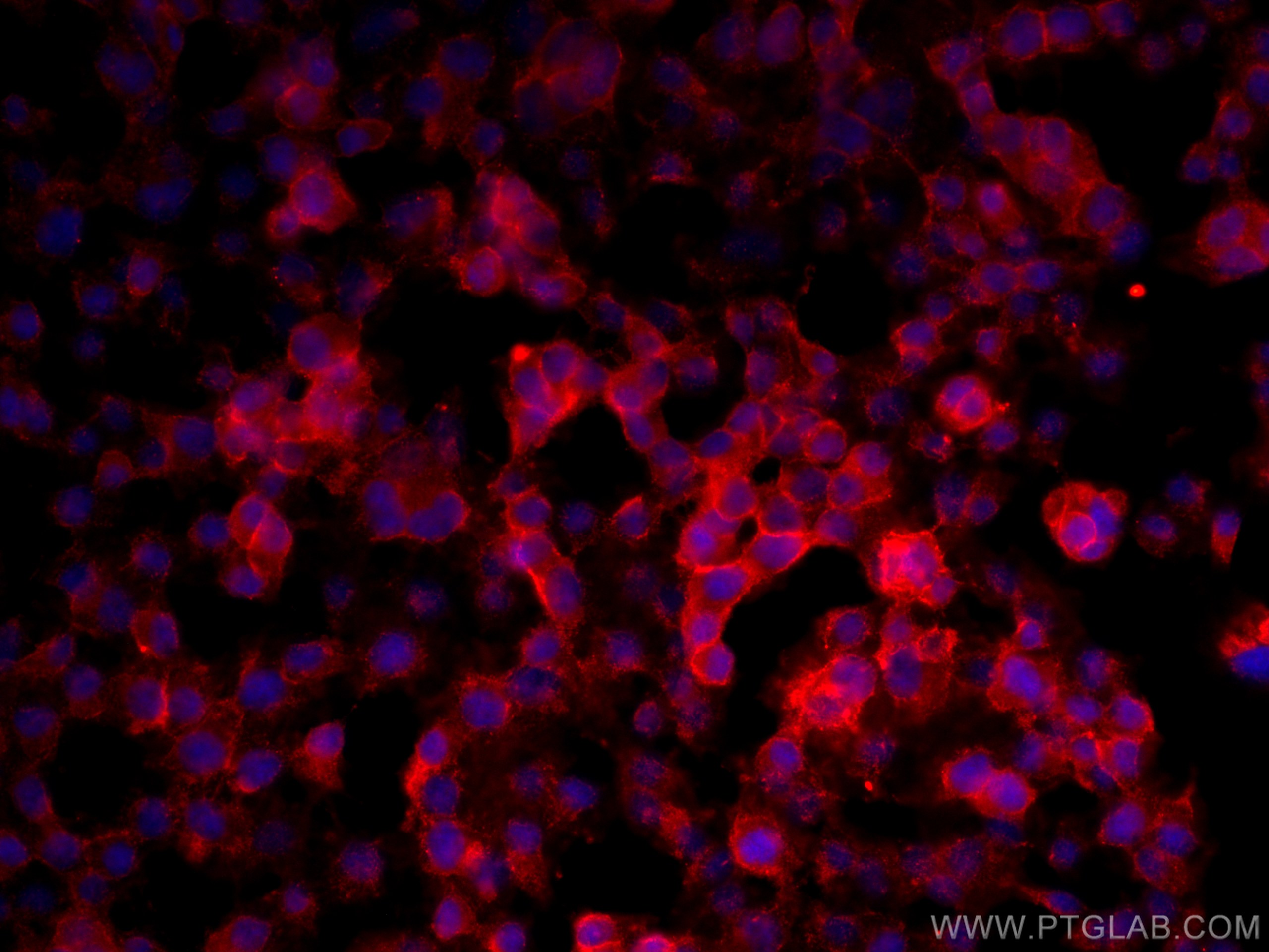 Immunofluorescence (IF) / fluorescent staining of PC-12 cells using FXYD6 Monoclonal antibody (68058-1-Ig)