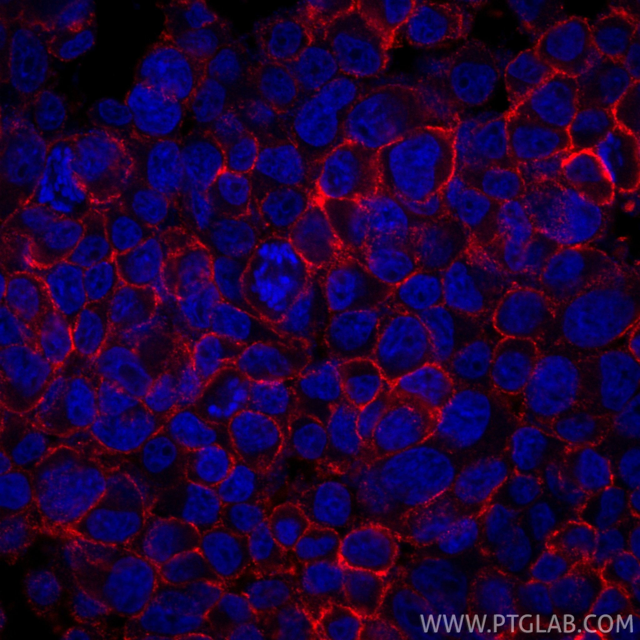 Immunofluorescent analysis of (4% PFA) fixed PC-12 cells using FXYD6 antibody (68058-1-Ig, Clone: 2H1B7 ) at dilution of 1:1000 and CoraLite®594-Conjugated Goat Anti-Mouse IgG(H+L) (SA00013-3). Immunofluorescence (IF) / fluorescent staining of PC-12 cells using FXYD6 Monoclonal antibody (68058-1-Ig)