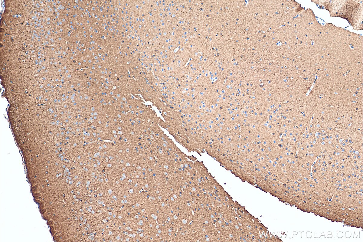 IHC staining of mouse brain using 68058-1-Ig