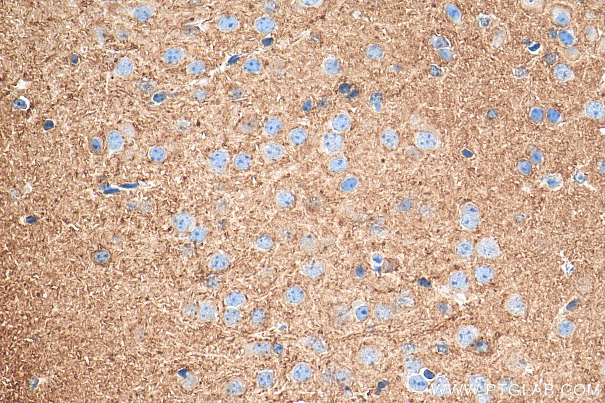 Immunohistochemistry (IHC) staining of mouse brain tissue using FXYD6 Monoclonal antibody (68058-1-Ig)