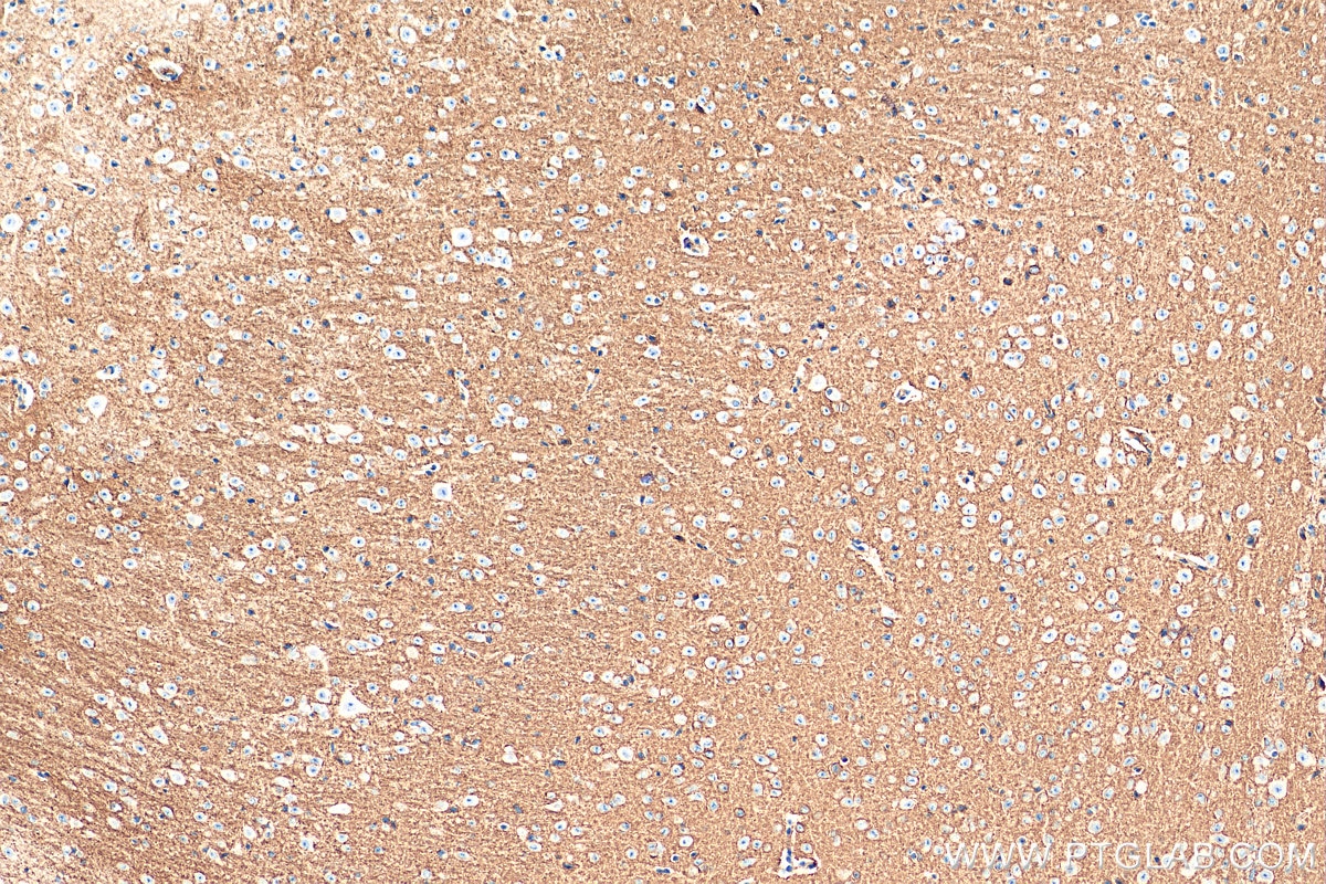 IHC staining of mouse cerebellum using 68058-1-Ig