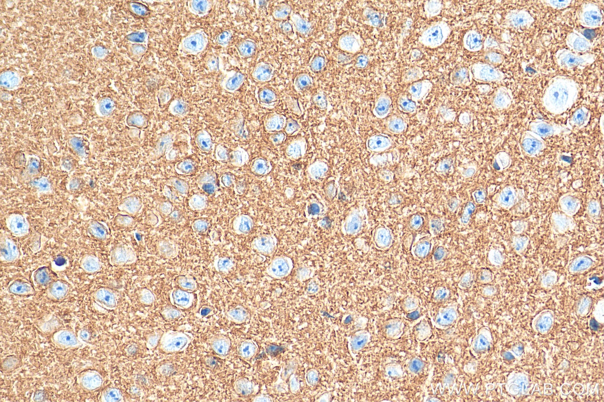 Immunohistochemistry (IHC) staining of mouse cerebellum tissue using FXYD6 Monoclonal antibody (68058-1-Ig)