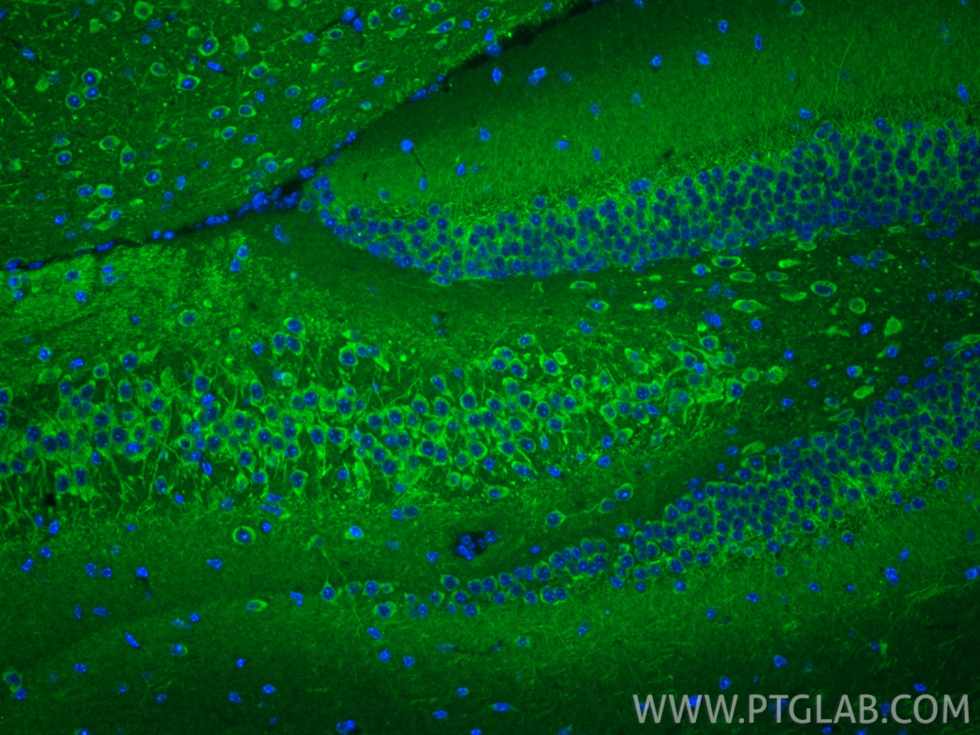 Immunofluorescence (IF) / fluorescent staining of mouse brain tissue using FXYD7 Polyclonal antibody (11465-1-AP)