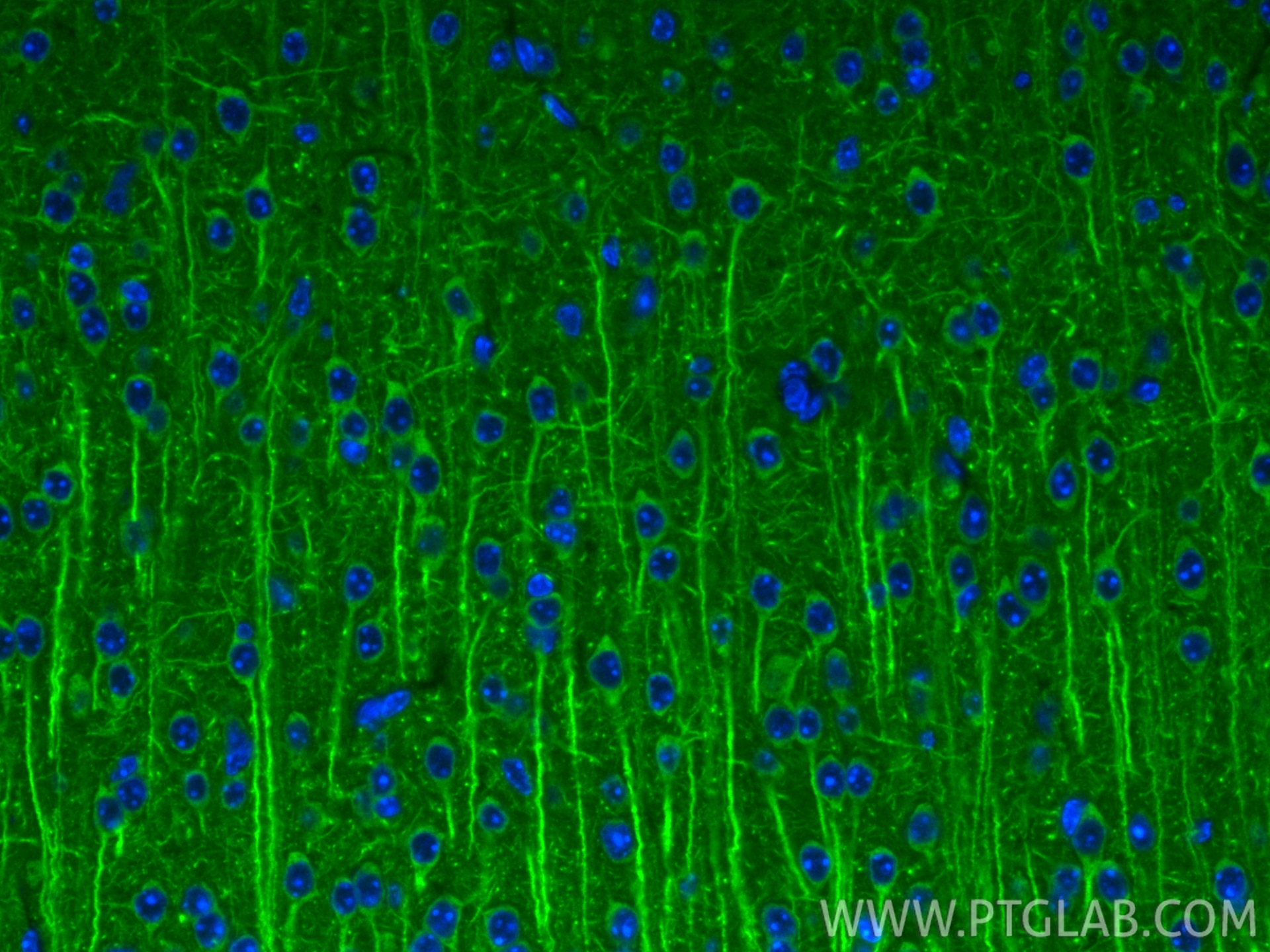 Immunofluorescence (IF) / fluorescent staining of mouse brain tissue using FXYD7 Polyclonal antibody (11465-1-AP)