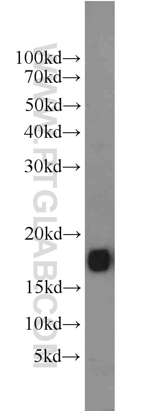 Western Blot (WB) analysis of mouse brain tissue using FXYD7 Polyclonal antibody (11465-1-AP)