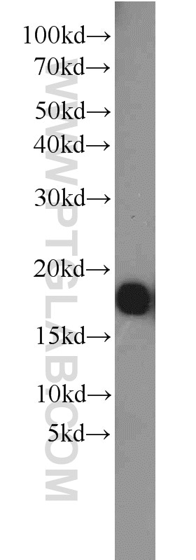 Western Blot (WB) analysis of human brain tissue using FXYD7 Polyclonal antibody (11465-1-AP)
