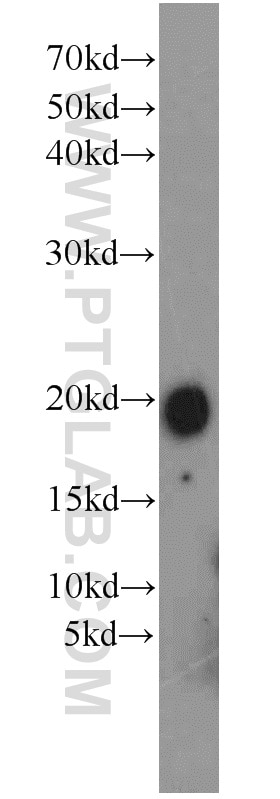 Western Blot (WB) analysis of rat brain tissue using FXYD7 Polyclonal antibody (11465-1-AP)