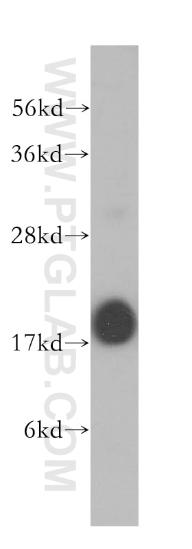 Western Blot (WB) analysis of human brain tissue using FXYD7 Polyclonal antibody (11465-1-AP)