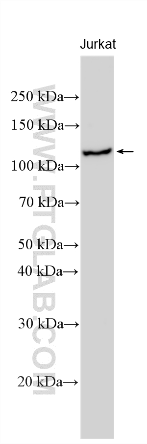Western Blot (WB) analysis of various lysates using FYB Polyclonal antibody (31553-1-AP)
