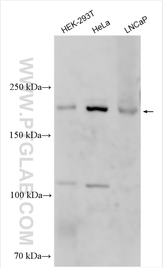 Western Blot (WB) analysis of various lysates using FYCO1 Polyclonal antibody (25730-1-AP)