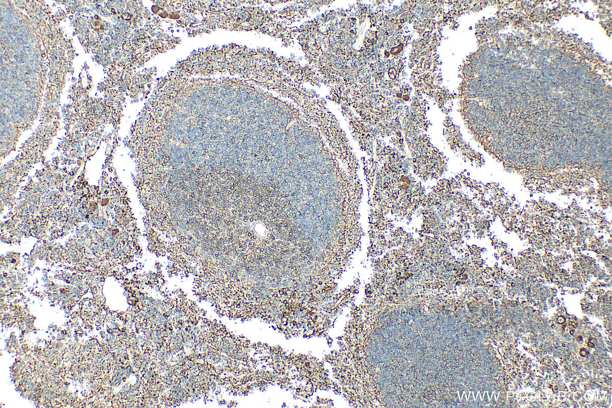 Immunohistochemistry (IHC) staining of mouse spleen tissue using FYN Polyclonal antibody (17237-1-AP)