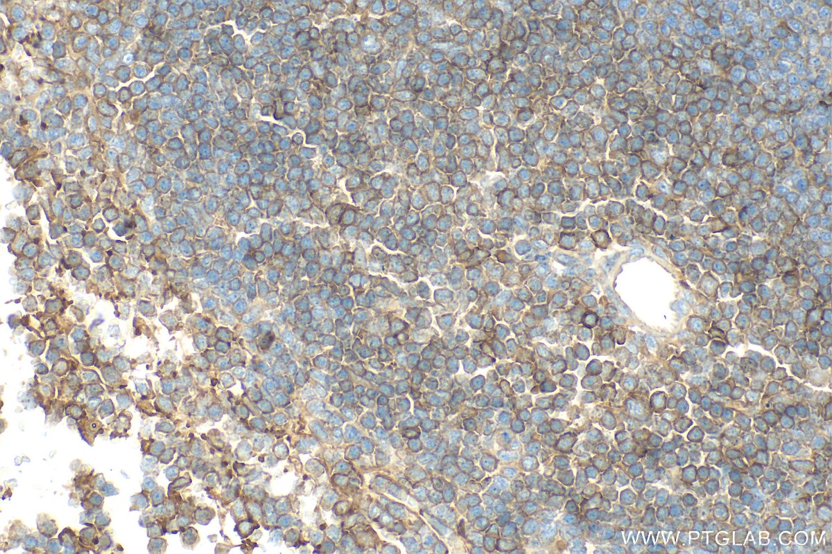 Immunohistochemistry (IHC) staining of mouse spleen tissue using FYN Polyclonal antibody (17237-1-AP)