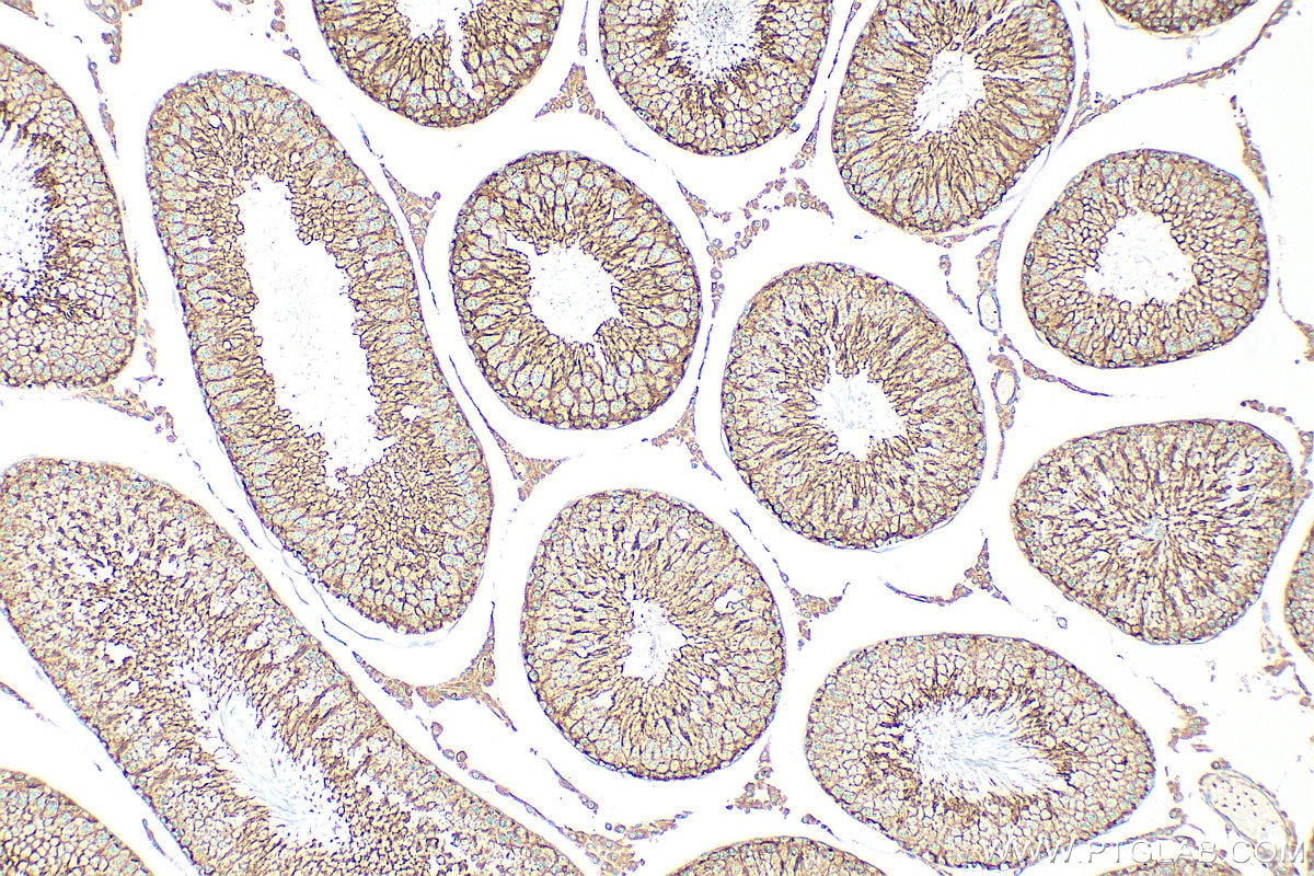Immunohistochemistry (IHC) staining of rat testis tissue using FYN Polyclonal antibody (17237-1-AP)