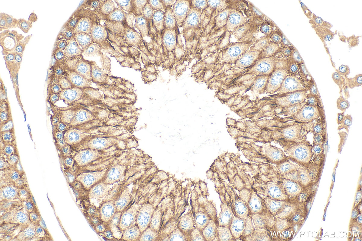 Immunohistochemistry (IHC) staining of rat testis tissue using FYN Polyclonal antibody (17237-1-AP)