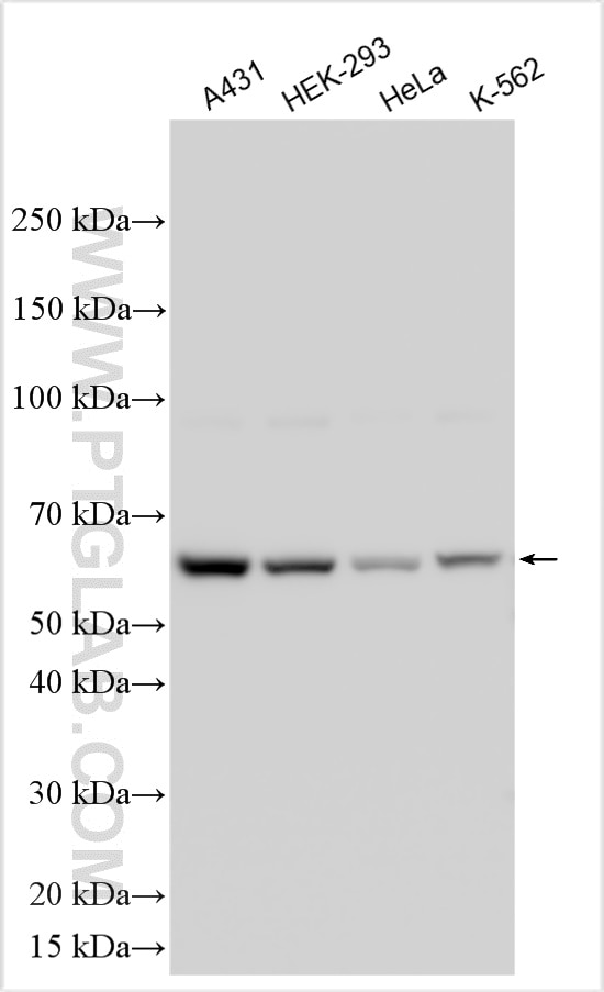 Western Blot (WB) analysis of various lysates using FYN Polyclonal antibody (17237-1-AP)