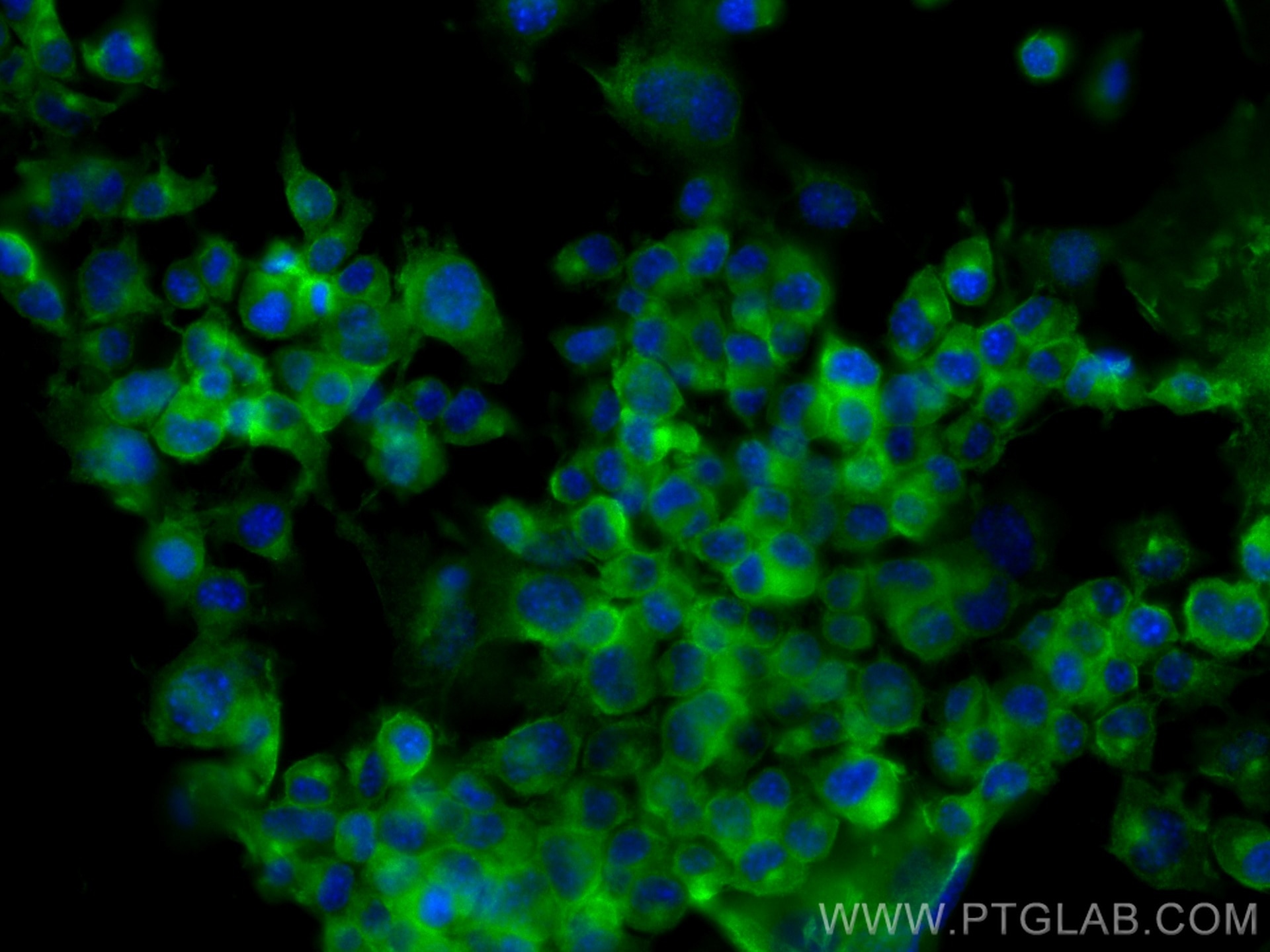 Immunofluorescence (IF) / fluorescent staining of Neuro-2a cells using FYN Monoclonal antibody (66606-1-Ig)