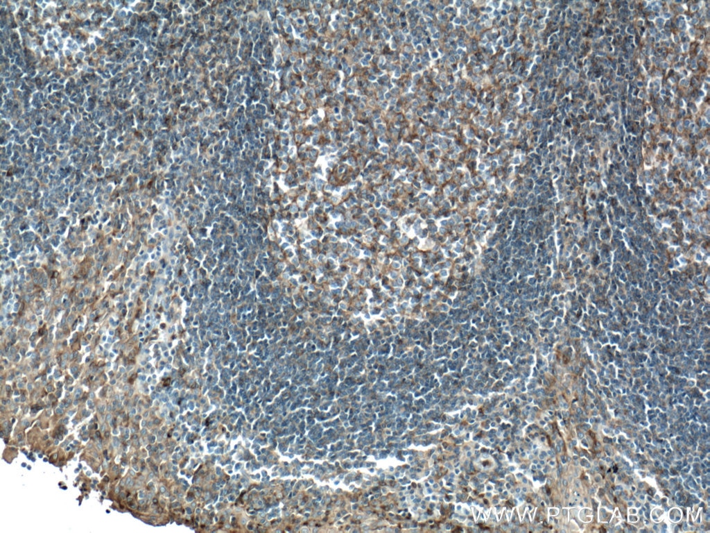 Immunohistochemistry (IHC) staining of human tonsillitis tissue using FYN Monoclonal antibody (66606-1-Ig)