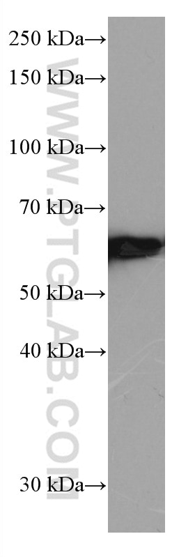 Western Blot (WB) analysis of HeLa cells using FYN Monoclonal antibody (66606-1-Ig)