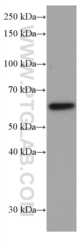 Western Blot (WB) analysis of MCF-7 cells using FYN Monoclonal antibody (66606-1-Ig)