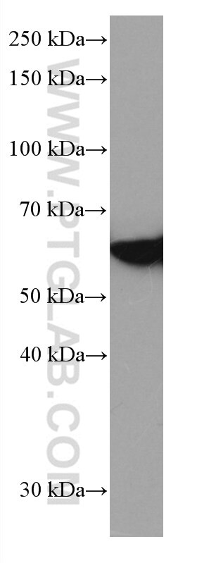 Western Blot (WB) analysis of Jurkat cells using FYN Monoclonal antibody (66606-1-Ig)