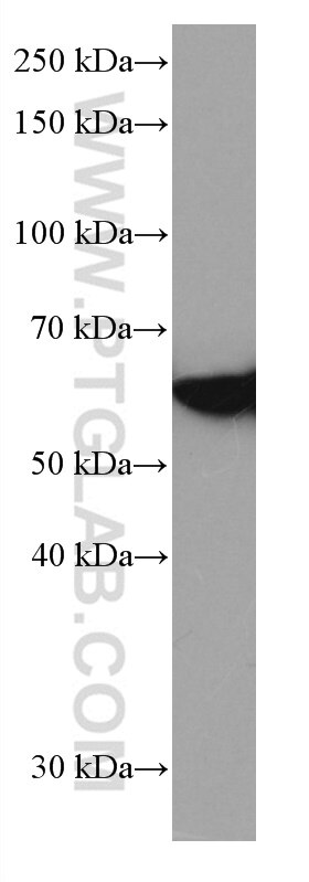 WB analysis of Jurkat using 66606-1-Ig