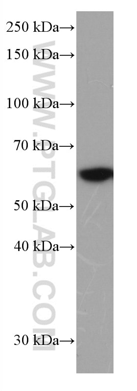 Western Blot (WB) analysis of HSC-T6 cells using FYN Monoclonal antibody (66606-1-Ig)